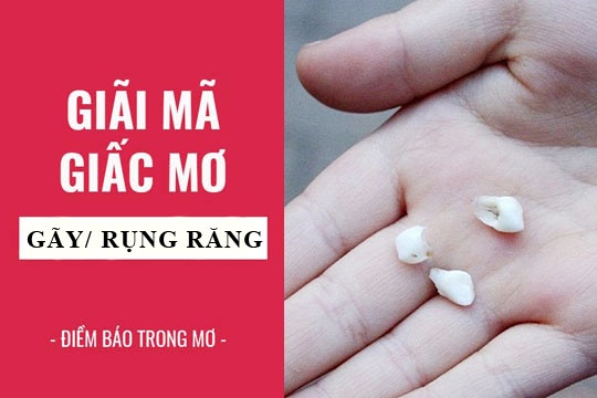 Giải mã giấc mơ bị rụng răng đánh con gì, điềm báo tốt hay xấu?